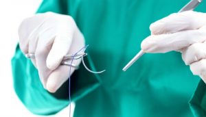 Chỉ khâu tự tiêu 