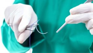 Tiêu chí lựa chọn đơn vị phân phối chỉ phẫu thuật